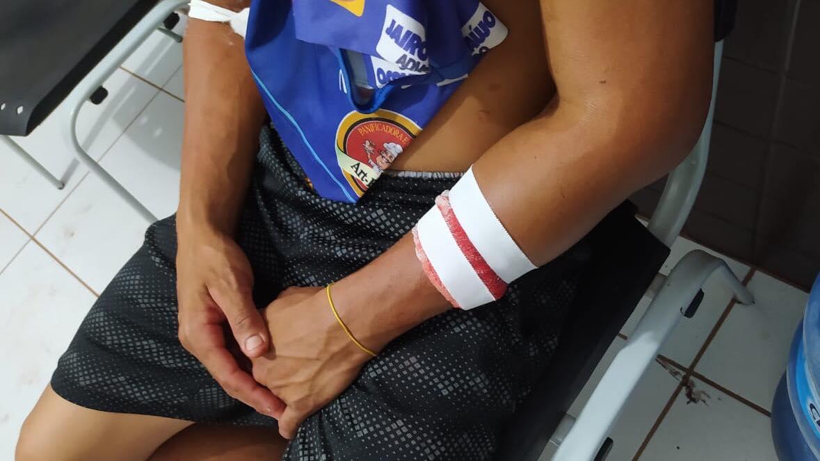 Três pessoas são baleadas em tentativa de homicídio no bairro Bom Remédio, em Itaituba