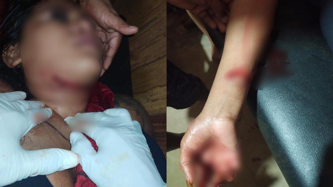 Mulher é ferida com golpes de gargalo de garrafa em comunidade garimpeira de Itaituba