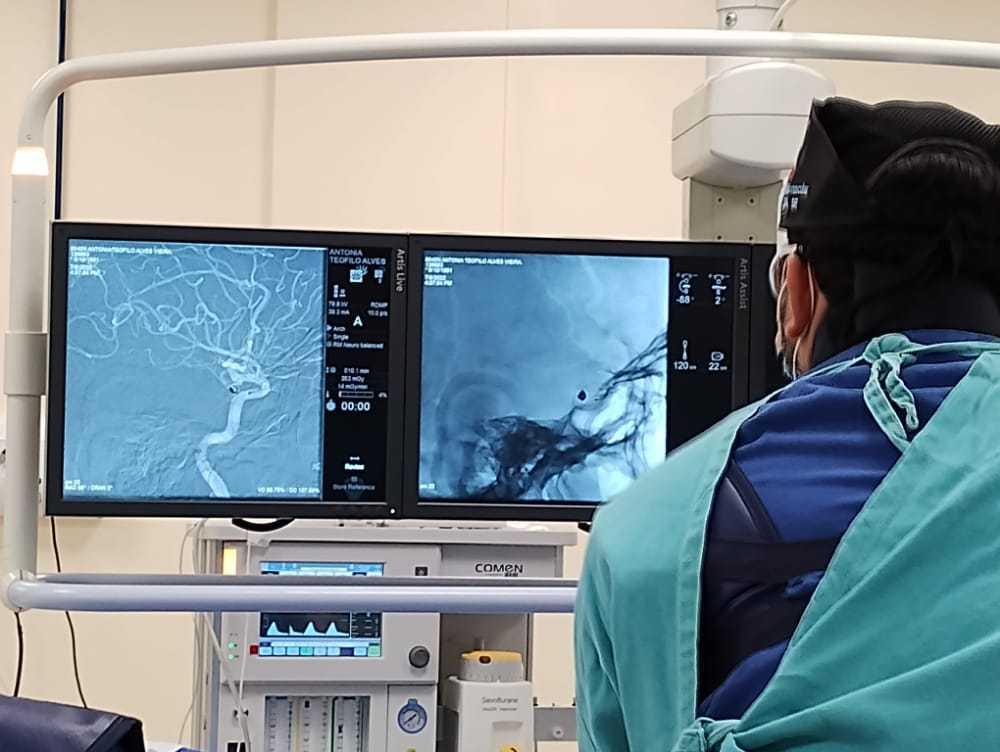 Com tecnologia de ponta, Hospital Regional de Marabá reverte aneurisma grave