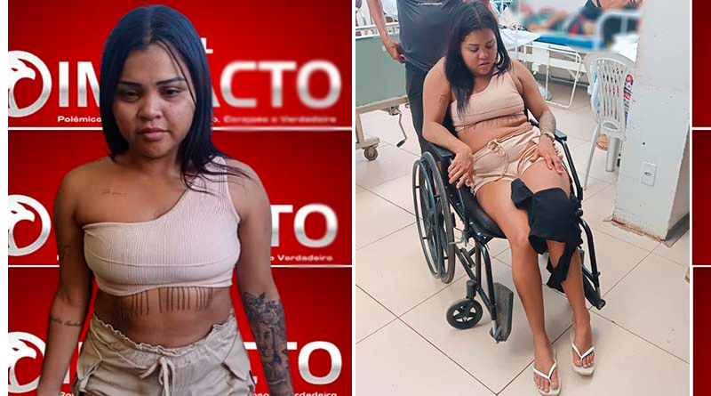 Com mandado de prisão em aberto, mulher baleada é presa ao dar nome errado no hospital