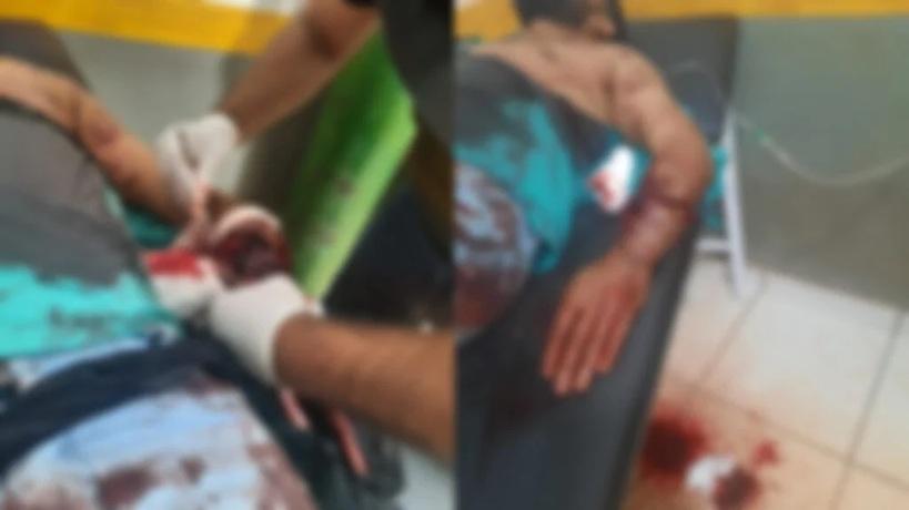 Homem é Baleado Durante Discussão em Bar na Comunidade de Crepurizinho