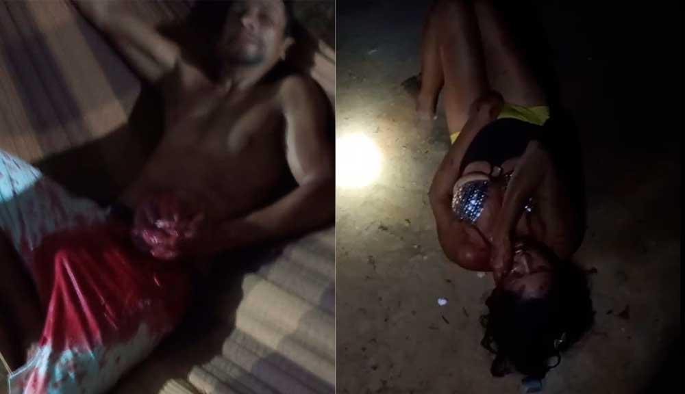 Briga em garimpo de Itaituba termina com homem gravemente ferido após esfaqueamento