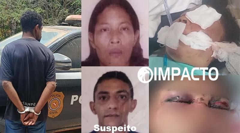 Mulher morre após agressão brutal em Uruará; companheiro é transferido para presídio