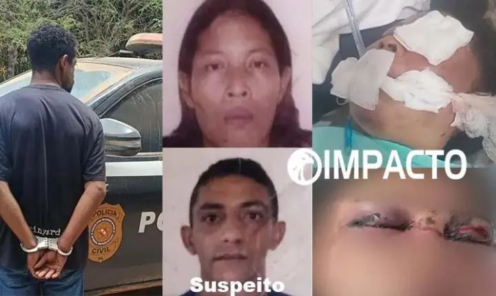 Mulher morre após agressão brutal em Uruará; companheiro é transferido para presídio